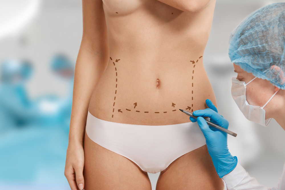 Advanced Body Surgery
